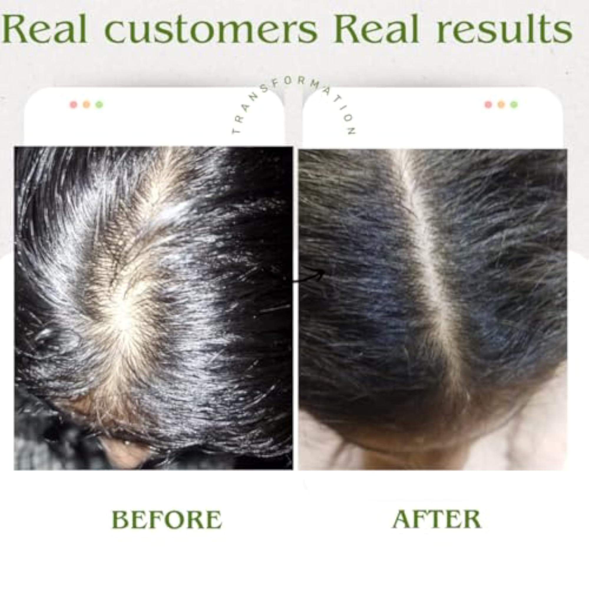 Natural Hair Growth Oil for Men & Women